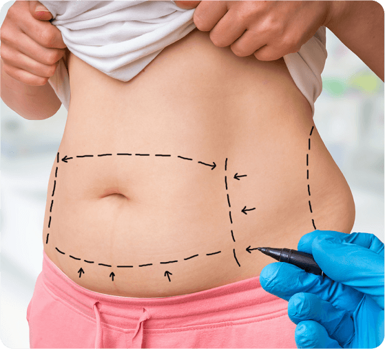 Liposuction in Dubai: Combining With Other Procedures