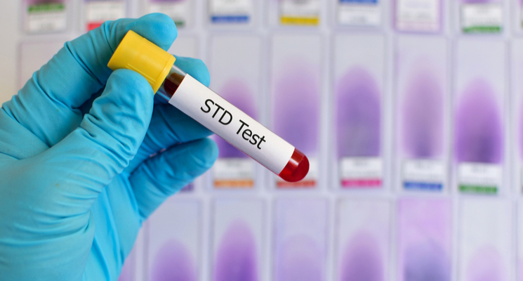 Why Medical Assessment Matters Before STD Testing at Tajmeels Clinic