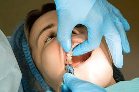 Permanent Tooth Replacement Options: What Are the Best Choices?