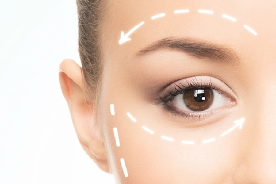 Brow Lift Surgery Dubai: Preparing for Your Procedure