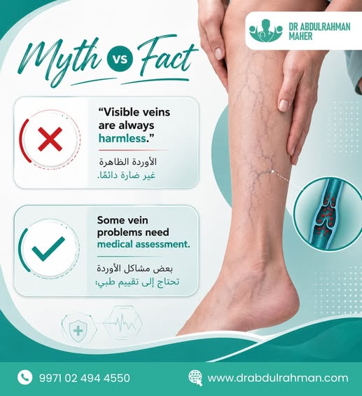 Spider Veins Dubai: Treatment and Specialist Care