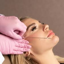 How to Prepare for Your First Thread Lift Appointment in Dubai