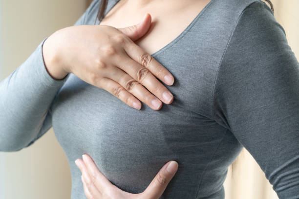 Professional Breast Lump Treatment in Dubai
