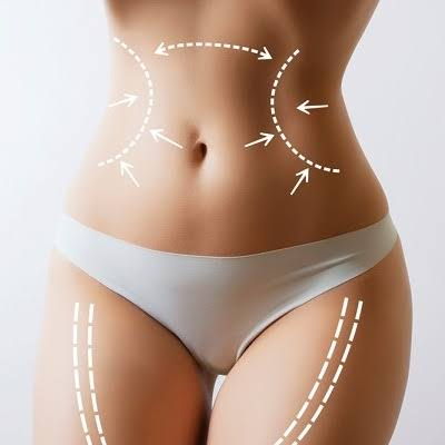 Liposuction Surgery in Dubai: Benefits and Risks
