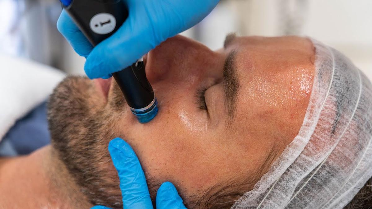 Benefits of Ultherapy Treatment in Dubai