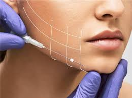 How Tajmeels Clinic Assesses Jawline and Cheek Concerns for Thread Lifts