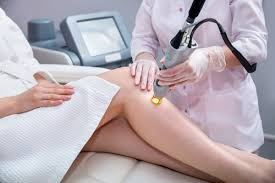 Which Laser Hair Removal Treatment Is Best for Facial Hair?
