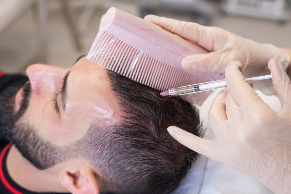 How Do Hormonal Changes Affect Results From PRP Hair Treatment?