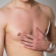 Can Gynaecomastia Surgery Improve Chest Shape and Definition?