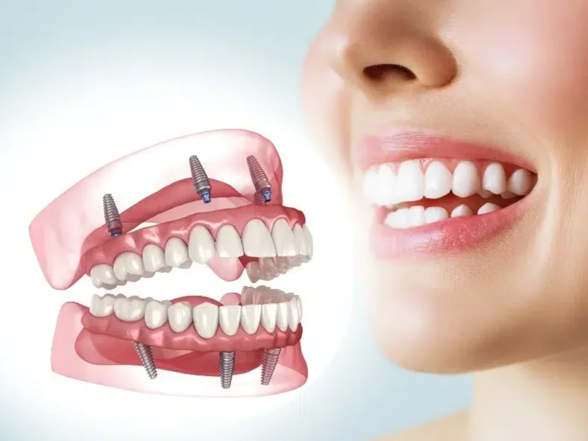 Rebuild Confidence with Advanced Smile Restoration in Houston