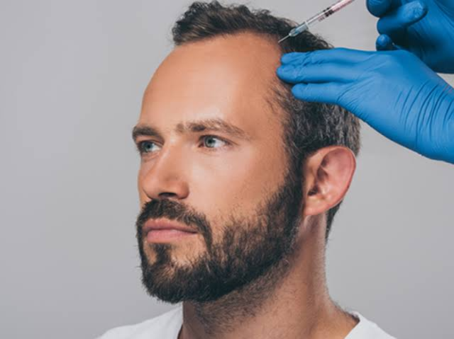Plasma Injection for Hairs in Dubai: Is It Effective?