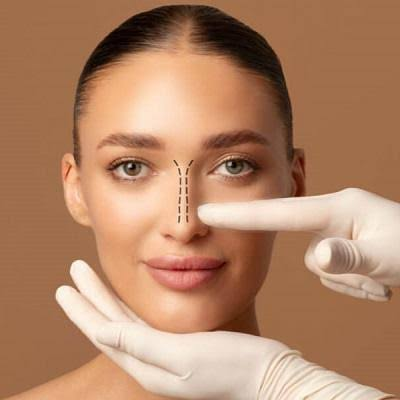 Rhinoplasty in Dubai: What to Expect