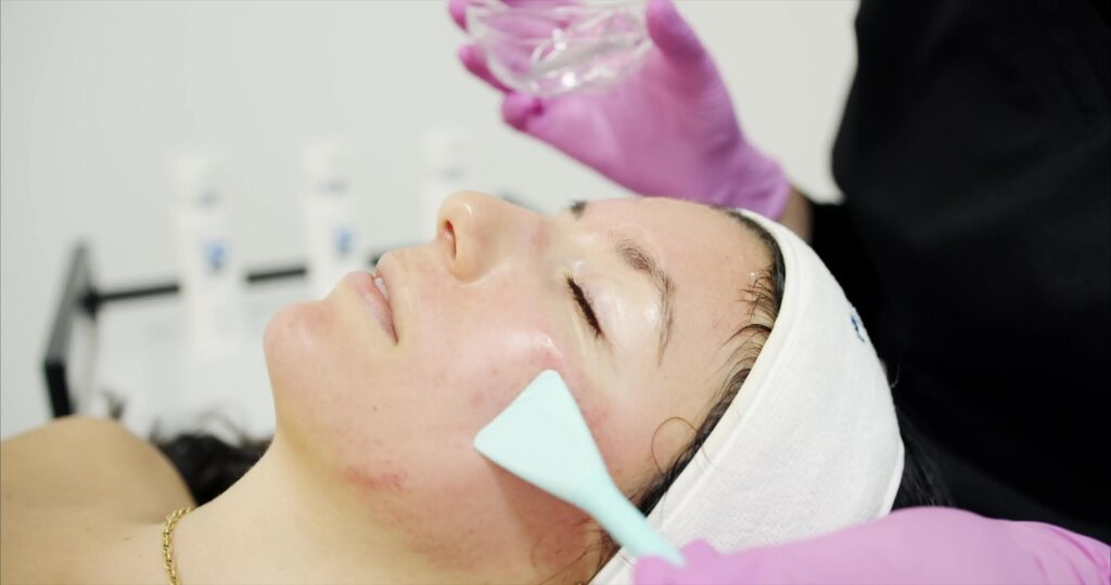 Chemical Peels in Dubai for Acne Marks