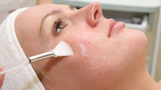 Chemical Peels in Dubai for Acne-Prone Skin