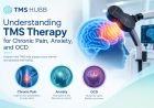 Understanding TMS Therapy for Chronic Pain, Anxiety, and OCD