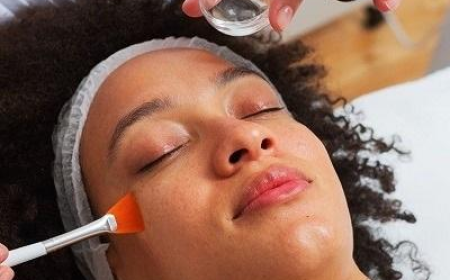 Chemical Peels in Dubai for Uneven Skin Tone