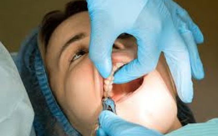 Permanent Tooth Replacement Options: What Are the Best Choices?