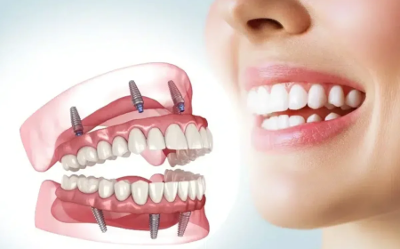 Rebuild Confidence with Advanced Smile Restoration in Houston