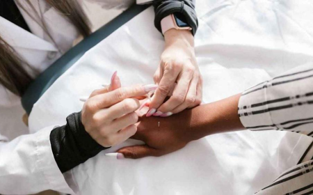 Microneedling Acupuncture Aftercare: 5 Tips for Faster Healing