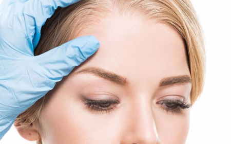 Brow Lift Surgery Dubai for a Youthful Look