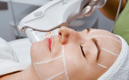 Ultherapy Treatment in Dubai for a Youthful Look