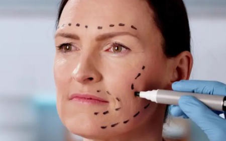 Can a Facelift Improve Loose Skin Around the Jaw?