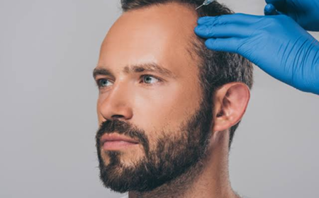Plasma injection for hairs in Dubai and Hair Renewal