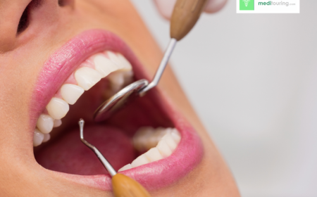Dental Implant Costs Abroad: What Is Included in Your Treatment Package?
