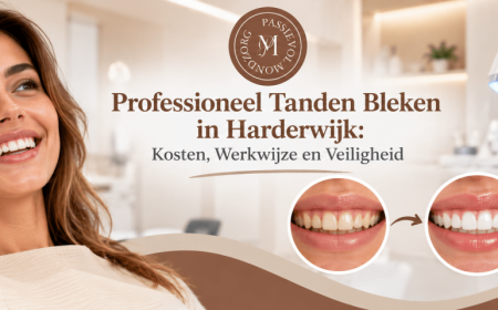 Professioneel Tanden Bleken in Harderwijk: Kosten, Werkwijze en Veiligheid